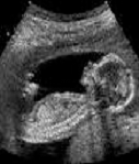 Nőgyógyászati ultrahang vizsgálatok
